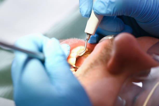 Best Emergency Dental Services for Seniors in Great Bend, KS